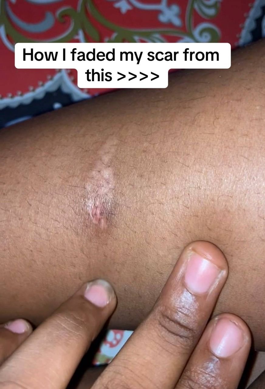 Customer result