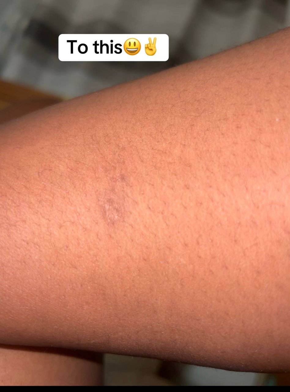 Customer result